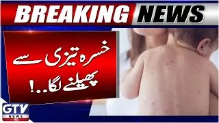 Measles Outbreak in Balochistan | 1700+ Children Affected, 23 Deaths | GTV News