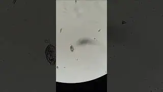 Under microscope #microscope #mikroskop #airkolam #biology
