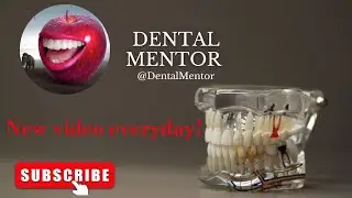 TMD, Parafunction and Occlusion for Natural Teeth and Implants