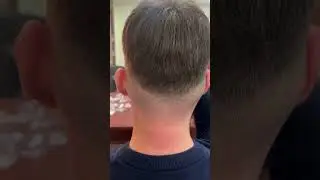 Refresh Tyler Hair System | Lavivid Hair System