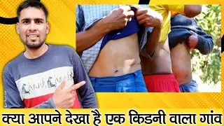 Single kidney Village in Asia! | Hokse village Nepal | Vmotive #short