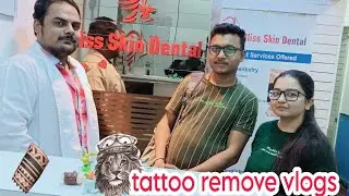 how to tattoo remove 100%permanent tattoo removal nearest by in Mumbai टैटू हटाने का अच्छी जगह
