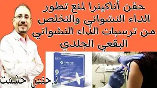 أسرار أناكينرا للداء النشواني/طريقة العمل/الجرعة وطريقة الإستعمال/الإستخدام والموانع/آثارها الجانبية