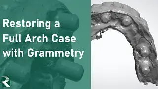 Restoring a Full Arch Case with Grammetry