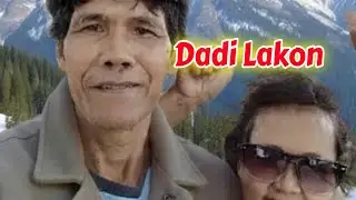 Dadi Lakon #lagujawa #campursari #congdut #lagubaru 