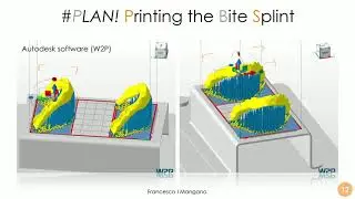 Essentials of Digital Dentistry- #PLAN!- Video 19