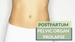 Postpartum Pelvic Organ Prolapse