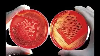 🦠Po jakim czasie probiotyk, który ma 2 mld bakterii w kapsułce, odbuduje florę jelitową❓ Obliczyłem❗