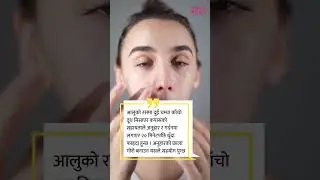 सनवर्नको उपचार आलु  | Nari Magazine
