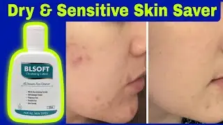 Blsoft Face Cleanser Lotion Review | Benefits, Usage & Honest Experience | Glowing Skin Tips#skin