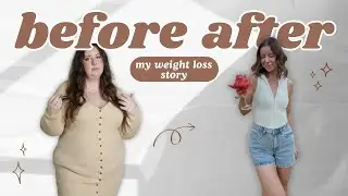 How I lost 65kgs | The Truth about Weight Loss Surgery