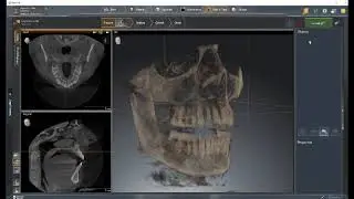 SICAT Air Tutorial 1 - Basic Navigation
