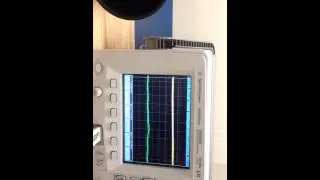 ECE230-Multistage amplifier project