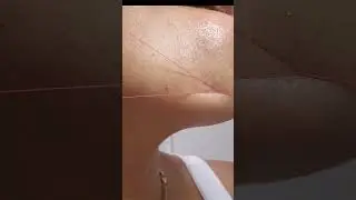 follow for more, #threading #hairremoval #satisfying #hairremovalmethods #beautycare #pcos