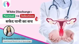 🩺 White Discharge &ndash; Normal vs Abnormal