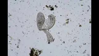 Weird (maybe damaged) microprobe under a microscope