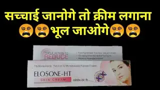 Elosone HT Cream Ke Side Effects | Elosone HT Cream Uses, Benefits, Side effects