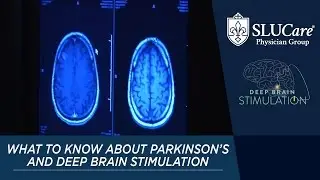 What You Need To Know About Parkinson's Disease & Deep Brain Stimulation