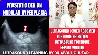 Prostate ultrasound | prostate ultrasound normal vs abnormal image appearance | KUB ultrasound 