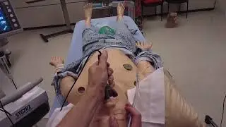 C Mac Intubation POV