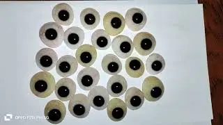 Best Artificial Eye lab in Bangladesh.