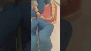 PROTHÈSE FIXÉE - EMPREINTE (PART 1/2)