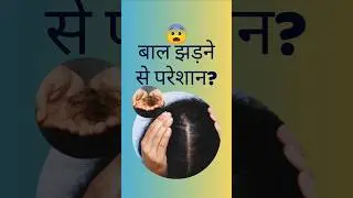 🌿Stop Hair Fall Naturally &ndash; Ayurvedic Trick that works fast!#quickhairfallcontrol#shortsfeed#shorts