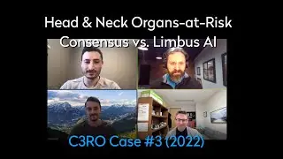 Head & Neck Organs-at-Risk: Consensus vs. Limbus AI