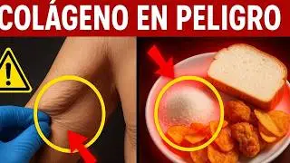 &iquest;Los Alimentos Que Comes Est&aacute;n Destruyendo Tu Col&aacute;geno?