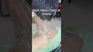 Neck Blackness Remove tips || #darkneck #skincare #pigmentation #shorts #youtubeshorts #viralshort