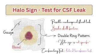 Halo Sign Explained | CSF Leak #neetpg2026