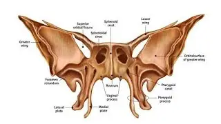 Sphenoid bone - greater wings and lesser wings.