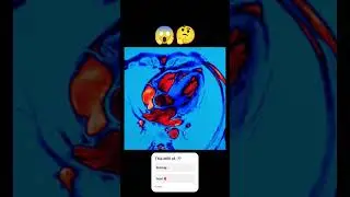 This MRI of..?😱🤔#art #artist #reels #shorts #shortvideo
