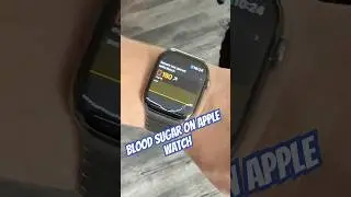 Glucose monitoring finally coming to Apple Watch!
