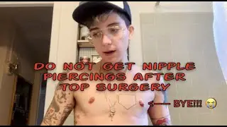 Top Surgery Scar Complications 9 Yrs-PostOp + Removing NipPiercings Forever