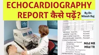 Echo report kaise padhe #drniteshraj HINDI mild MR,mild TR,EF,RWMA, hypertrophy,PAH, sys,dias dysf