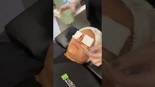 Superficial chemical peel