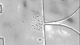 Natural formation of biofilm at bottleneck with Cyclidium