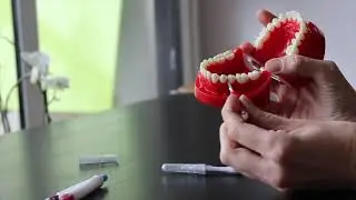 LES BROSSETTES INTERDENTAIRES (UN BROSSAGE EFFICACE)