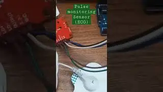 Pulse rate checking with Arduino|| iot project ideas|| mini projects #arduino #iot
