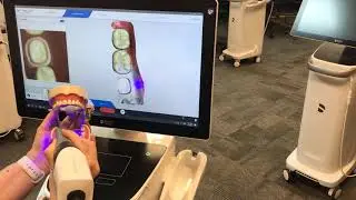 CEREC Primescan Quad scanning
