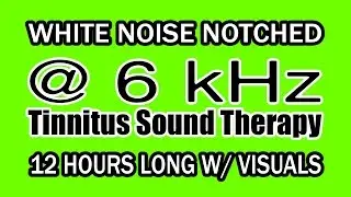 White Noise - Notch Filtered at 6 kHz for Tinnitus Therapy w/ Visuals