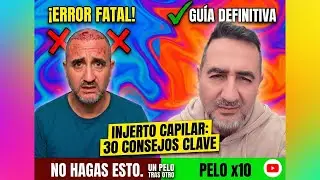 Después del Injerto Capilar: Lo Prohibido que Nadie Te Dice