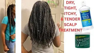 In-Between Wash Day Routine - How I Take Care of My Scalp | Natural Hair | Winter | Grease | 2026