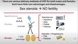 Hormone replacement therapy in Kallmann syndrome / hypogonadotropic hypogonadism.