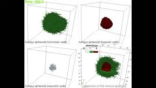 In silico model of a 3D tumour spheroid development