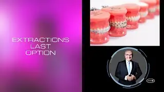 no extraction