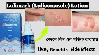 Lulimark Lotion Review | Luliconazole Lotion | Lulimark Lotion Use Benefits And benefit