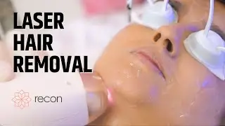 Laser Hair Removal: How it Works, Cost and more at  Recon !