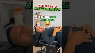 Herniated disc fix! Stop back and leg pain.Chiropractor fixes his own disc bulge. #shorts #sciatica